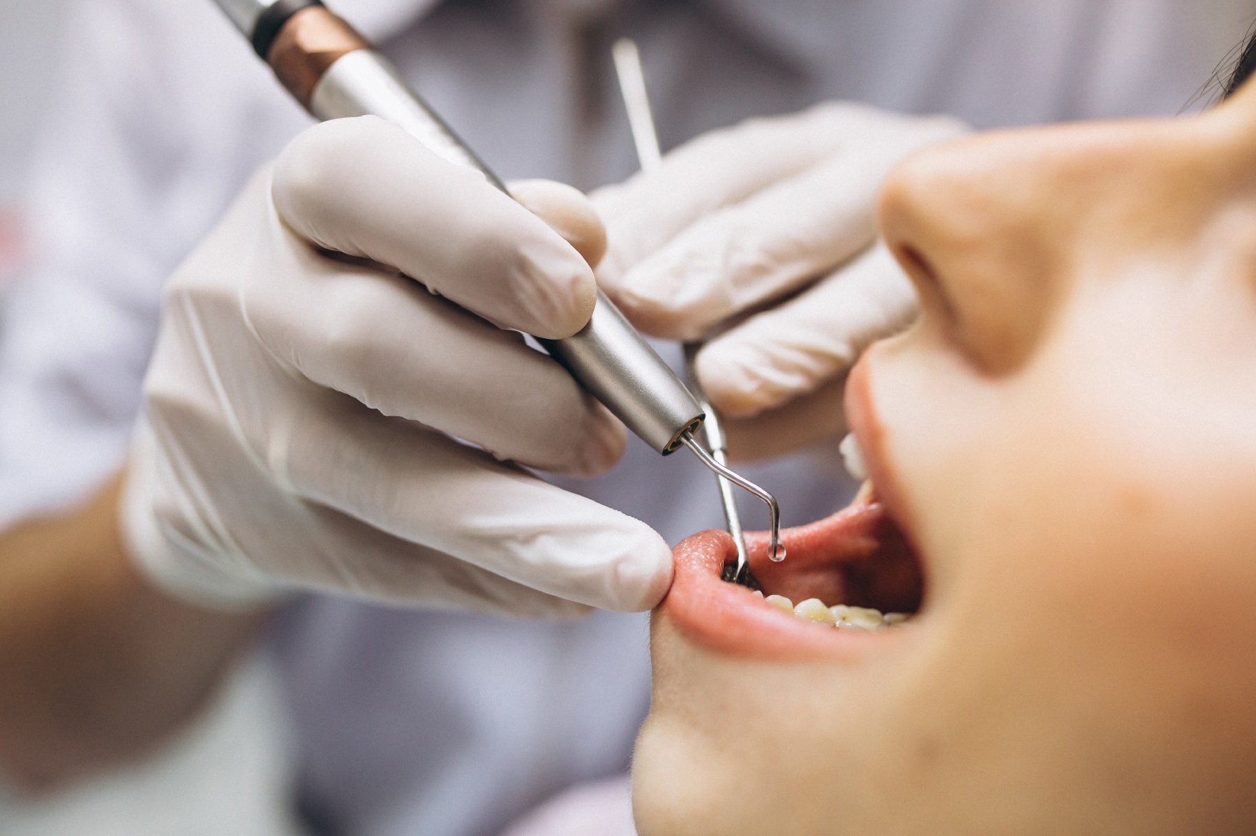 Valoración de tratamientos dentales conservadores en Alicante