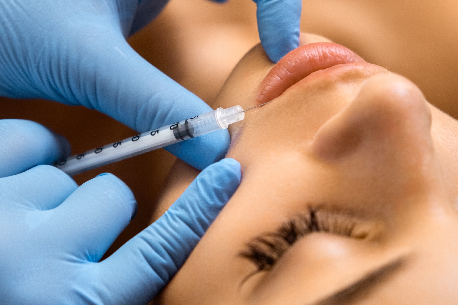 Tratamiento de estética facial en Alicante en Clínica Ruiz de la Cuesta