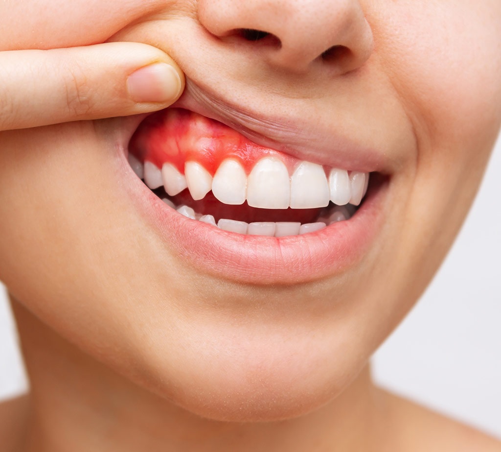 Revisión de encías en una consulta de periodoncia en Alicante