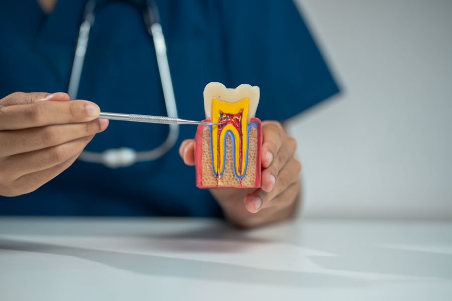 Médico enseñando un tratamiento de endodoncia