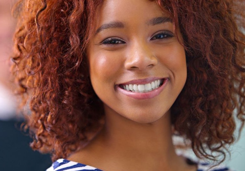 Sonrisa natural como objetivo de un tratamiento de estética dental