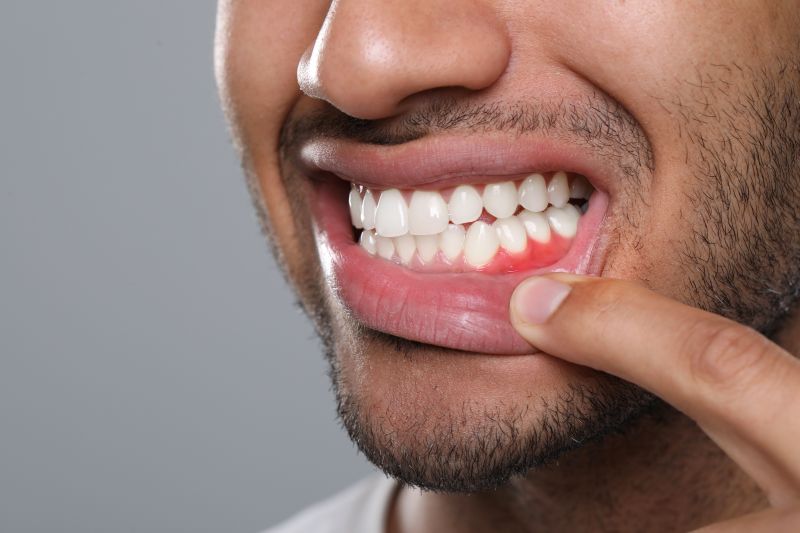 hombre con problemas en las encías en tratamiento periodontal en Alicante