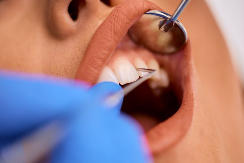 niña haciendo limpieza periodontal en sus encías