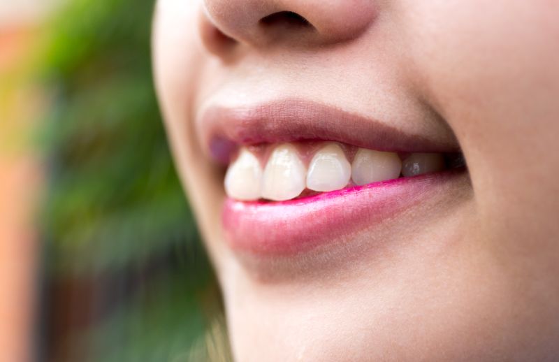 imagen de una niña después de su tratamiento periodontal en Alicante